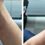Some-Apple-Watch-wearers-are-experiencing-allergic-reactions-from-wearing-the-device-nbsp (1)