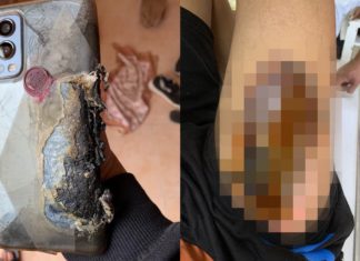 OnePlus Nord 2 Blast Again