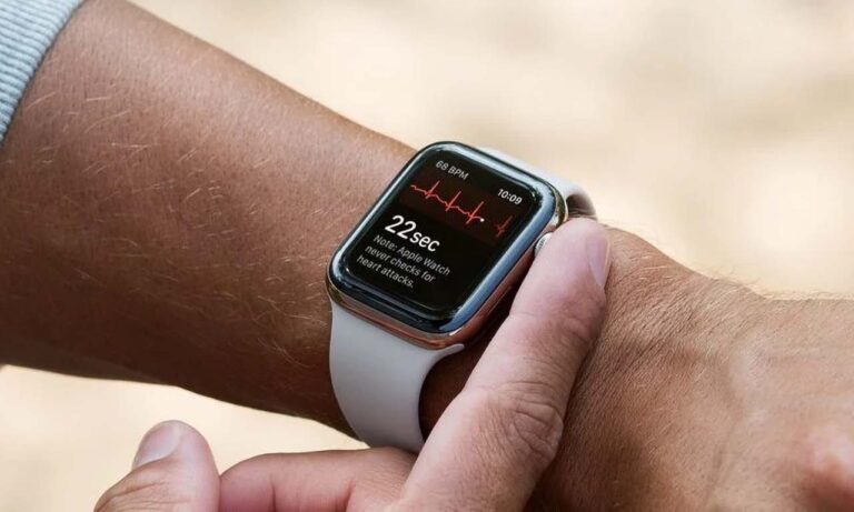 Apple Watch EKG