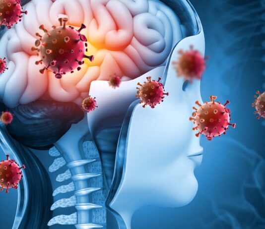 Βρέθηκε κρίσιμο μοτίβο πίσω από τη μακρά COVID; Μακρά Long COVID