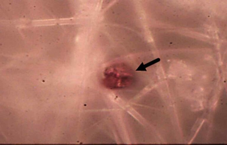 Microplastics