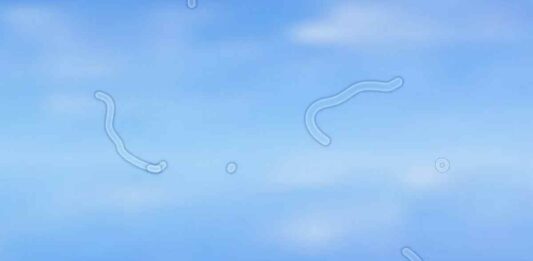 Τι είναι τα περίεργα στίγματα που βλέπουμε με τα μάτια μας! Δείτε φωτογραφία οπτικό πεδίο