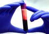 blood test