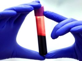 blood test