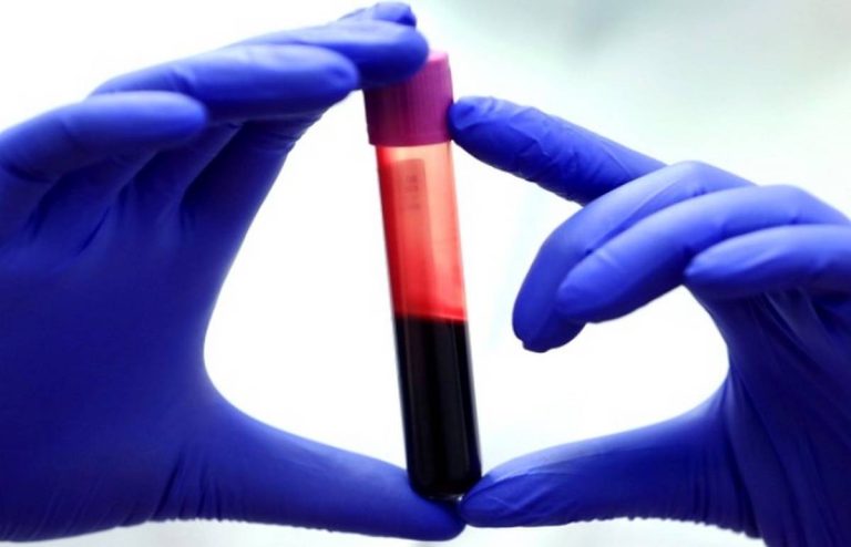 blood test