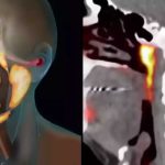 organ human body