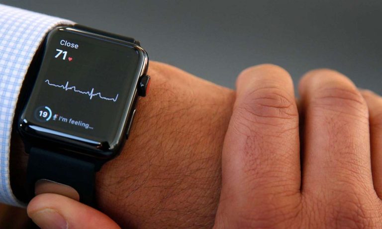 Apple Watch AFib EKG