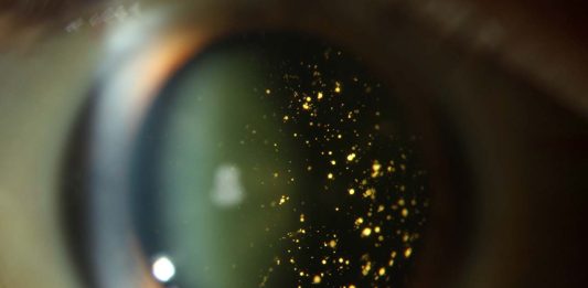 αστεροειδής υάλωση