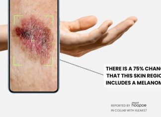 Google καρκίνο