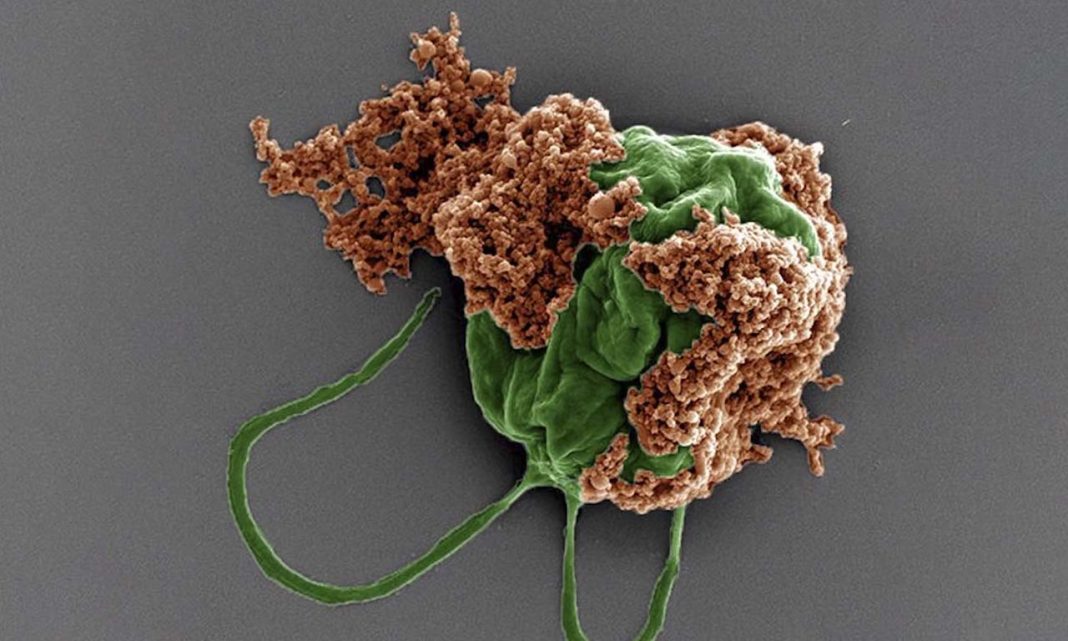 βιοϋβριδικά μικρορομπότ καρκίνο
