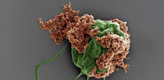 Καταπολέμηση επιθετικών καρκίνων με τη βοήθεια της ασπιρίνης βιοϋβριδικά μικρορομπότ καρκίνο