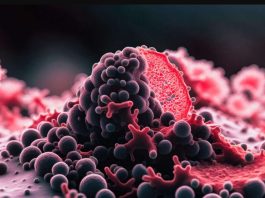 Αυτές οι συνεχείς ενοχλήσεις σύμπτωμα καρκίνου κατανόηση καρκίνου