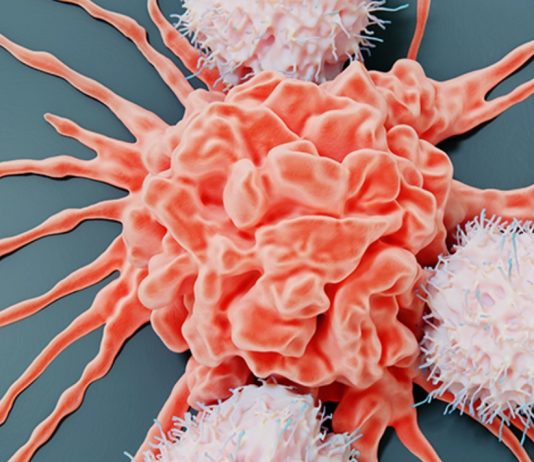 Ο δολοφόνος του καρκίνου ίσως βρίσκεται μέσα στο σώμα μας! Μια ανακάλυψη ορόσημο δολοφόνος καρκίνου θάνατοι