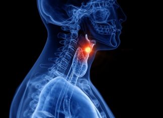 φωνή καρκίνος