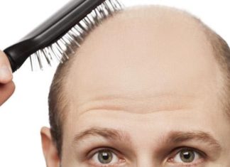 gel κληρονομική τριχόπτωση