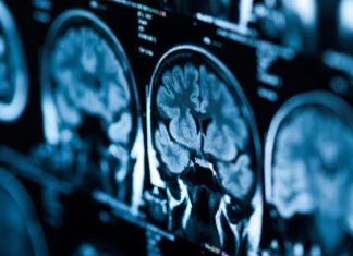 περίεργο εγκέφαλό μας