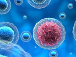 πρώιμα συμπτώματα καρκίνου