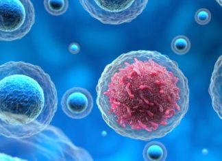 πρώιμα συμπτώματα καρκίνου