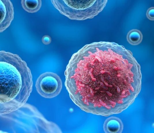 πρώιμα συμπτώματα καρκίνου