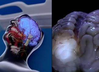 Προσομοίωση θάνατο