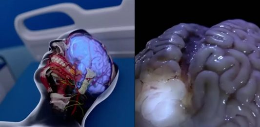 Προσομοίωση δείχνει τι θα συμβεί στον εγκέφαλό μας με το θάνατό μας Προσομοίωση θάνατο