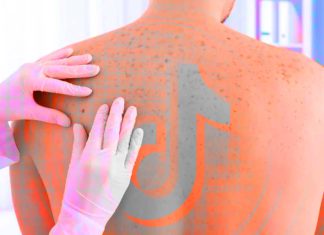 καρκίνο δέρματος TikTok