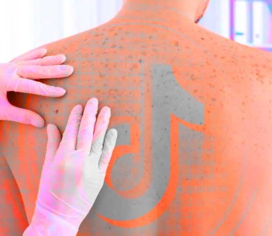 καρκίνο δέρματος TikTok