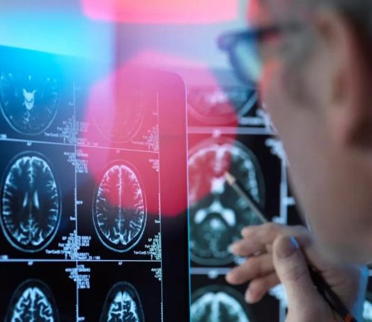 έρευνα πρόσθετα τρόφιμα