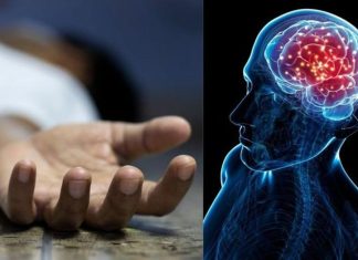 εγκέφαλο θάνατος