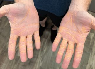 σημάδια χέρια