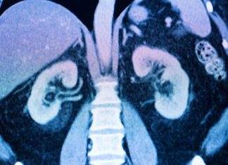 εμφιαλωμένο νερό