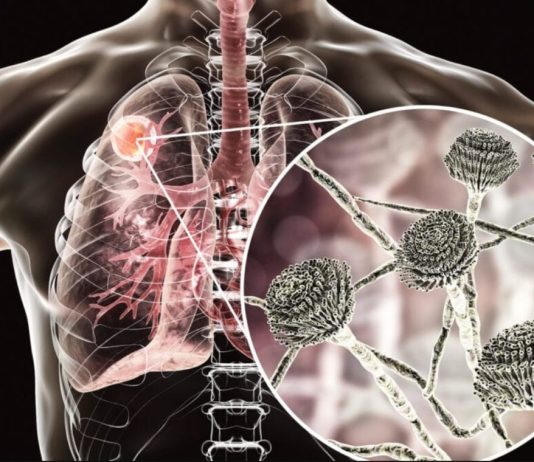 θανατηφόρο μύκητα