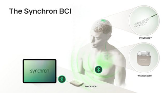 Apple Syncron εγκέφαλος 