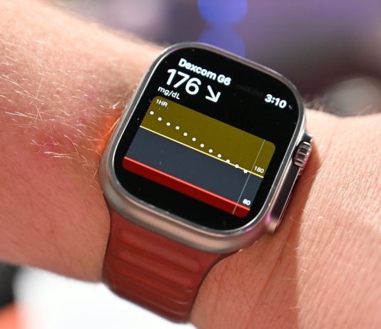 watchOS 26.2: Έρχονται τέσσερις μεγάλες αλλαγές για το Apple Watch Apple Watch μέτρηση σακχάρου