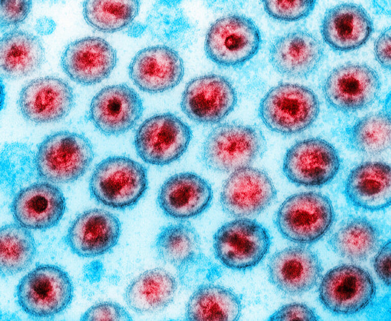 HIV