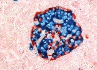 Διαβήτη Τύπου 1