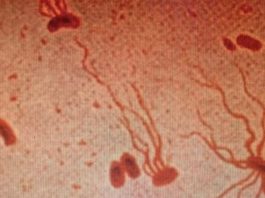 αρχαίος δολοφόνος μικρόβια