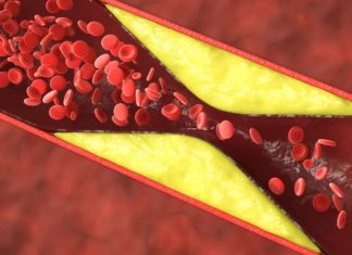 Καρδιακές ανακοπές