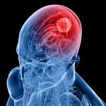 2a6eaf5061f989dc128bf7a3dc2d86fd_XL