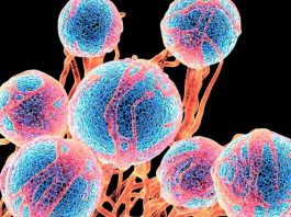 Γιατί αντιμετωπίζουμε μεγαλύτερο κίνδυνο καρκίνου από τους γονείς μας! κίνδυνο καρκίνου