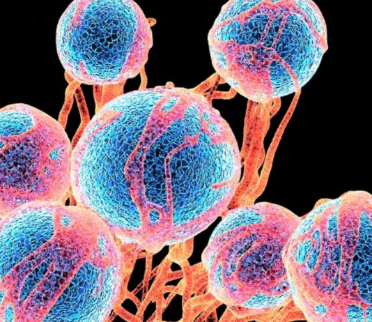 Γιατί αντιμετωπίζουμε μεγαλύτερο κίνδυνο καρκίνου από τους γονείς μας! κίνδυνο καρκίνου