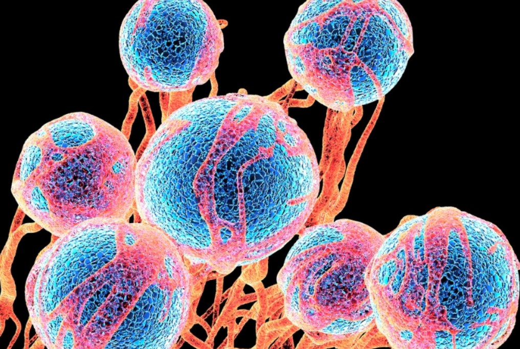 cancer risk κίνδυνο καρκίνου