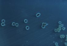 Αυτός ο αρχαίος φονιάς είναι ανθεκτικός στα αντιβιωτικά! Salmonella enterica