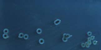 Αυτός ο αρχαίος φονιάς είναι ανθεκτικός στα αντιβιωτικά! Salmonella enterica