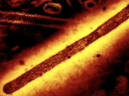 Η πρώτη παγκοσμίως περίπτωση θανάτου από H5N5 είναι γεγονός! h5n5