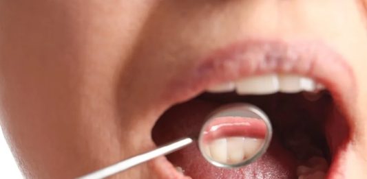 Τα πρώιμα συμπτώματα καρκίνου του στόματος: Αιτίες, διάγνωση και η σημασία της πρόληψης oran cancer