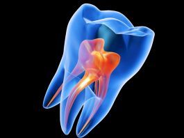 Και όμως αυτό το gel αναγεννά τα δόντια! gel δόντια