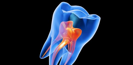 Και όμως αυτό το gel αναγεννά τα δόντια! gel δόντια