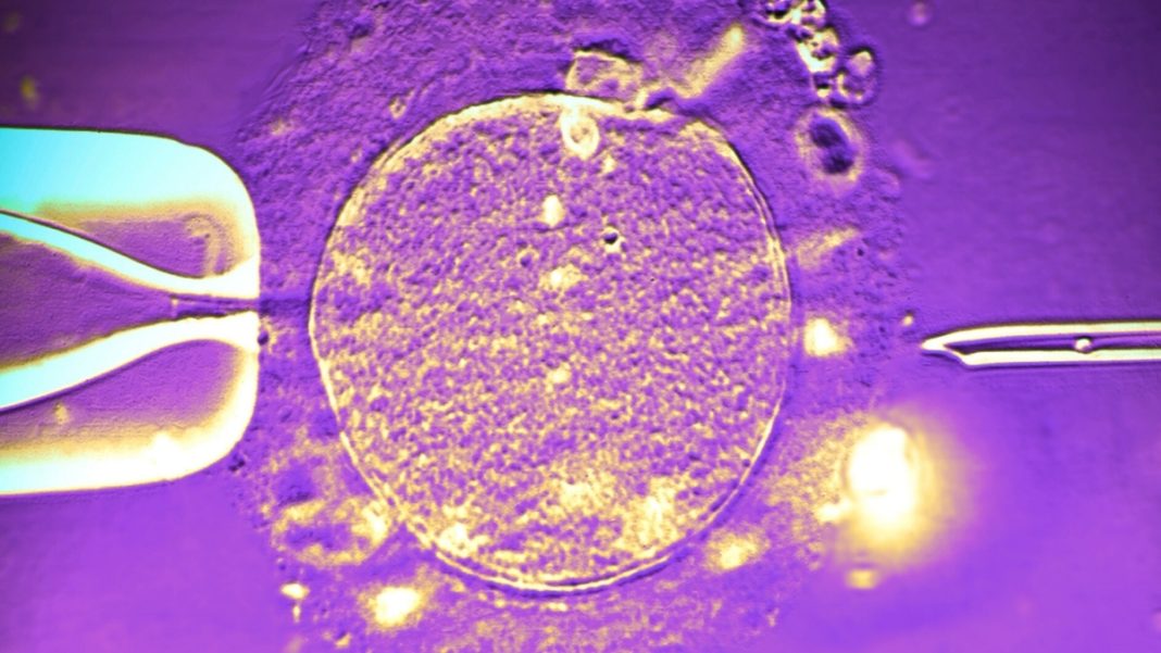 IVF-treatment-concept