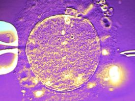 Δότης σπέρματος με σπάνιο γονίδιο καρκίνου, έγινε πατέρας σχεδόν 200 παιδιών! Και στην Ελλάδα